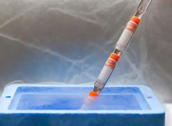 細胞凍存 細胞凍存